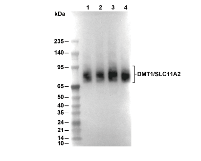 DMT1/SLC11A2 Antibody [C16J1] WB