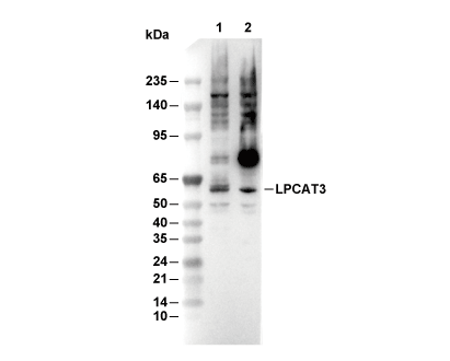LPCAT3 Antibody [H3J6] WB