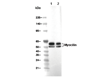 Myocilin Antibody [D9K2] WB
