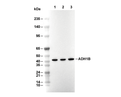 Alcohol dehydrogenase 1B Antibody [G20E17] WB