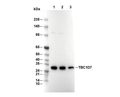 TBC1D7 Antibody [D5H17] WB
