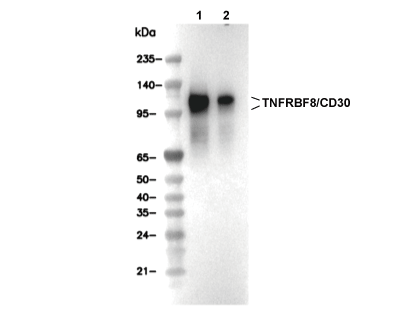 TNFRSF8/CD30 Antibody [G5N10] WB