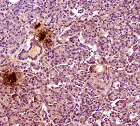 F5352-IHC1