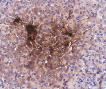 F5352-IHC1