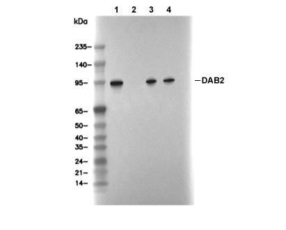 DAB2 Antibody [K17C17] WB