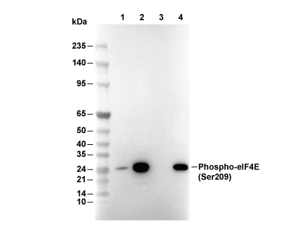Phospho-eIF4E (Ser209) Antibody [G23F17] WB