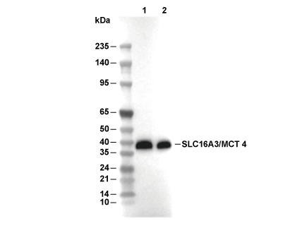 MCT4/SLC16A3 Antibody (Rabbit mAb) [D23C24] WB