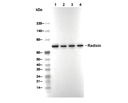 Radixin Antibody [C5B23] WB