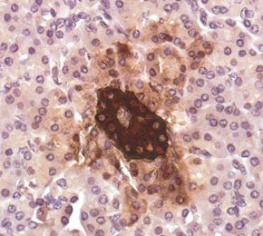 F5835-IHC1