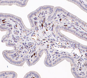F5951-IHC1