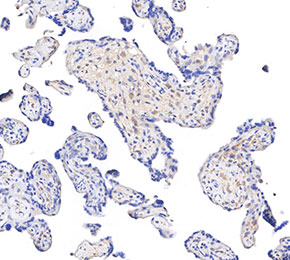 F5992-IHC1