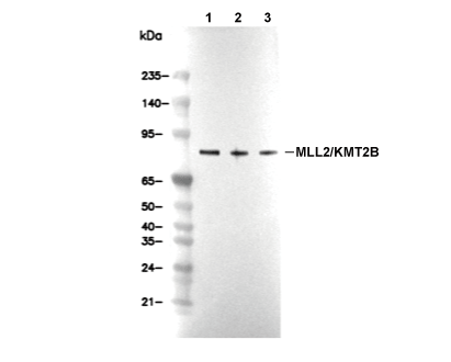 MLL2 C-terminal Antibody [L16L11] WB