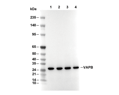 VAPB Antibody [L11L13] WB