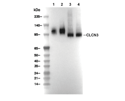 CLCN3 Antibody [E24D24] WB