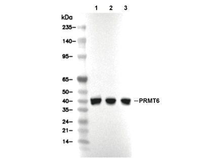 PRMT6 Antibody [K2N19] WB