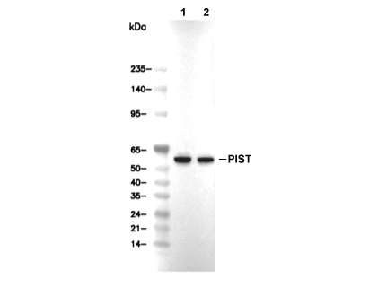 GOPC Antibody [D5A8] WB