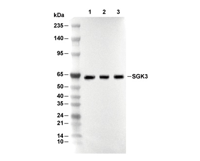 SGK3 Antibody [D18P23] WB