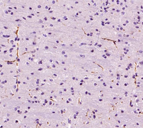 F6741-IHC1