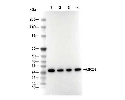 ORC6 Antibody [E10G21] WB