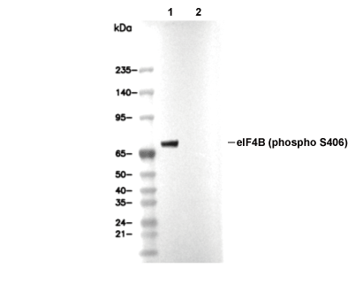 Phospho-eIF4B (Ser406) Antibody [E13A7] WB