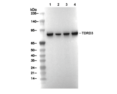 TDRD3 Antibody [C20J18] WB