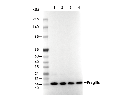 Fragilis Antibody [E3D3] WB