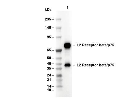 IL-2R&beta;/p75 Antibody [D16J3] WB