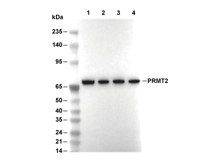 PRMT5 Antibody [M17F9] WB