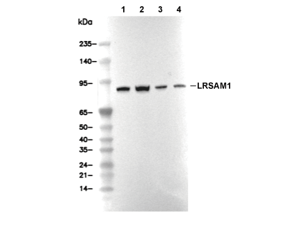 LRSAM1 Antibody [K13D2] WB