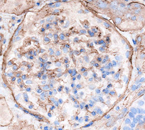F7452-IHC1