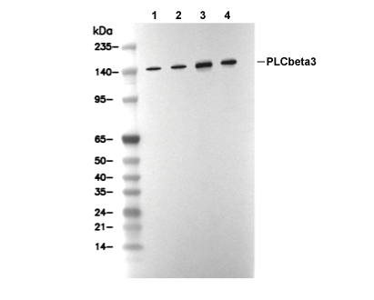 PLC&beta;3 Antibody [E24D14] WB