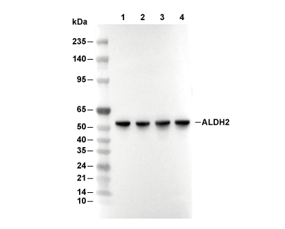 ALDH2 Antibody [C21F15] WB