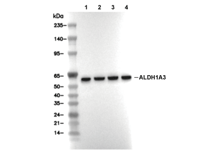 ALDH1A3 Antibody [J5E20] WB
