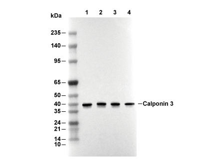 Calponin 3 Antibody [N11H14] WB