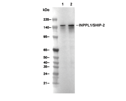 SHIP2 Antibody [D4N9] WB