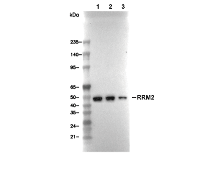 RRM2 Antibody [L9E5] WB