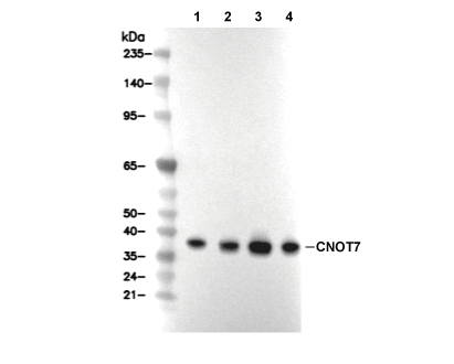 CNOT7 Antibody [N8J19] WB