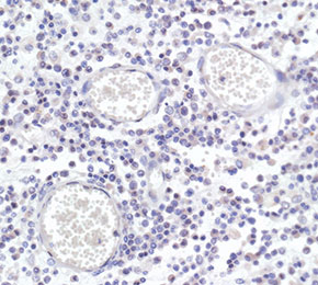F8242-IHC1