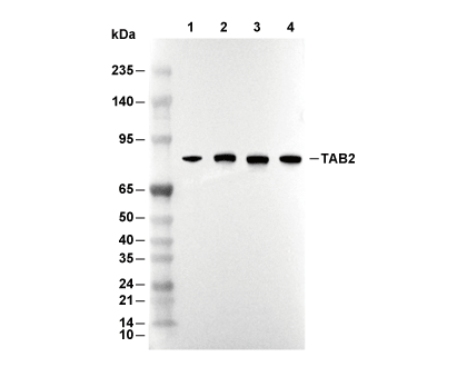 TAB2 Antibody [E6J10] WB