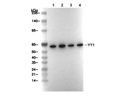 YY1 Antibody [M11B11] WB