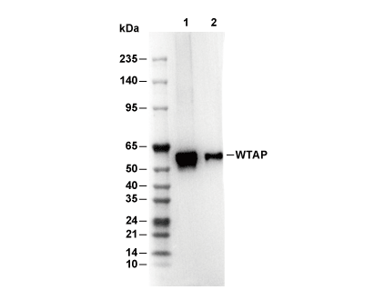 WTAP Antibody [E21M11] WB