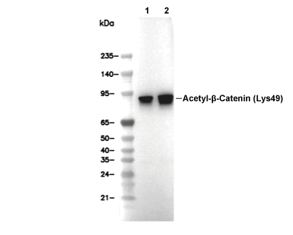 Acetyl-&beta; Catenin (Lys49) Antibody [N20A14] WB