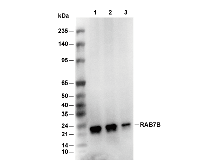 RAB7B Antibody [K12N3] WB