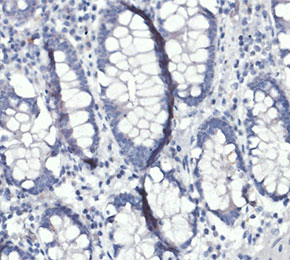 F8584-IHC1
