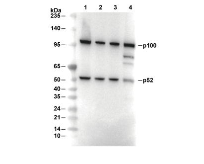 NF-&kappa;B2 p100/p52 Antibody [D6C15] WB