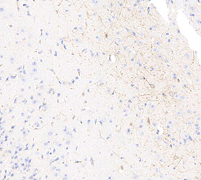F8706-IHC1