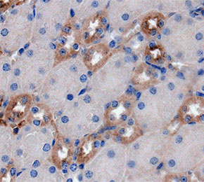 F8739-IHC1