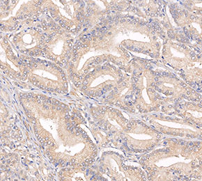 F8862-IHC1