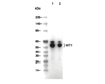 WT1 Antibody [J23C5] WB