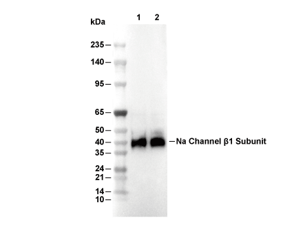 Na Channel &beta;1 Subunit Antibody (Rabbit mAb) [F4D21] WB